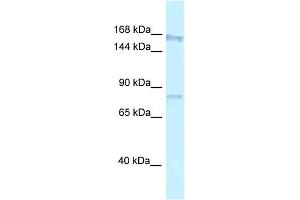 WB Suggested Anti-Arhgap5 Antibody   Titration: 1. (ARHGAP5 Antikörper  (N-Term))