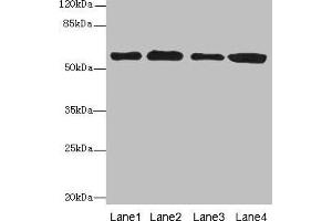 Western blot All lanes: TXNRD1 antibody at 5 μg/mL Lane 1: Jurkat whole cell lysate Lane 2: A549 whole cell lysate Lane 3: MCF-7 whole cell lysate Lane 4: Hela whole cell lysate Secondary Goat polyclonal to rabbit IgG at 1/10000 dilution Predicted band size: 71, 60, 66, 61, 55, 68, 51 kDa Observed band size: 60 kDa (TXNRD1 Antikörper  (AA 1-497))