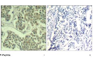 Image no. 1 for anti-Eukaryotic Translation Initiation Factor 2 Subunit 1 (EIF2S1) (pSer49) antibody (ABIN319275) (EIF2S1 Antikörper  (pSer49))