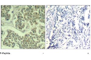 Image no. 1 for anti-Eukaryotic Translation Initiation Factor 2 Subunit 1 (EIF2S1) (pSer49) antibody (ABIN319276) (EIF2S1 Antikörper  (pSer49))