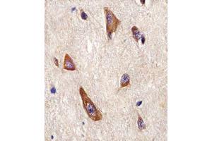 (ABIN6243251 and ABIN6577964) staining LRRK2 in Human brain tissue sections by Immunohistochemistry (IHC-P - paraformaldehyde-fixed, paraffin-embedded sections). (LRRK2 Antikörper  (C-Term))