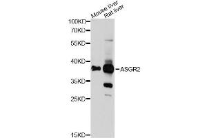 Western blot analysis of extracts of various cell lines, using ASGR2 Antibody (ABIN6290077) at 1:1000 dilution. (Asialoglycoprotein Receptor 2 Antikörper)