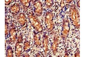 Immunohistochemistry (IHC) image for anti-Nudix (Nucleoside Diphosphate Linked Moiety X)-Type Motif 1 (NUDT1) (AA 49-82) antibody (ABIN7142858)