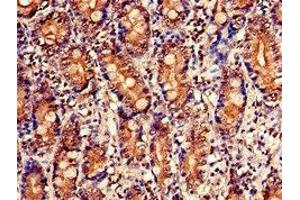 Immunohistochemistry of paraffin-embedded human small intestine tissue using ABIN7142858 at dilution of 1:100 (NUDT1 Antikörper  (AA 49-82))