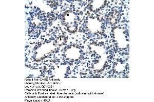 Rabbit Anti-CARS Antibody  Paraffin Embedded Tissue: Human Lung Cellular Data: Alveolar cells Antibody Concentration: 4. (CARS Antikörper  (N-Term))
