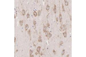 Immunohistochemical staining of human hippocampus with PREX1 polyclonal antibody  shows moderate cytoplasmic positivity in neuronal cells. (PREX1 Antikörper)