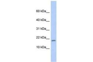 Image no. 1 for anti-Ribosomal Protein S15 (RPS15) (C-Term) antibody (ABIN6744000) (RPS15 Antikörper  (C-Term))