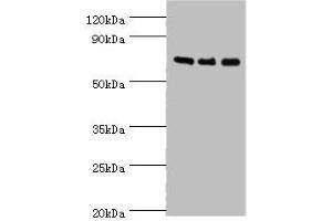 Western blot All lanes: AKAP10 antibody at 7 μg/mL Lane 1: 293T whole cell lysate Lane 2: Hela whole cell lysate Lane 3: HepG2 whole cell lysate Secondary Goat polyclonal to rabbit IgG at 1/10000 dilution Predicted band size: 74 kDa Observed band size: 74 kDa (AKAP1 Antikörper  (AA 413-662))
