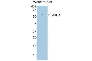 Western blot analysis of the recombinant protein. (ANGPTL3 Antikörper  (AA 17-460))