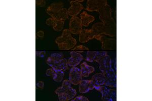 Immunofluorescence analysis of Human placenta using MYO5B antibody (ABIN6129305, ABIN6144287, ABIN6144288 and ABIN6224655) at dilution of 1:100. (MYO5B Antikörper  (AA 1440-1690))
