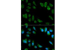 Immunofluorescence analysis of MCF-7 cells using IL1RN antibody. (IL1RN Antikörper)