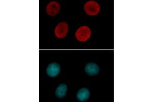 Histone H4 acetyl Lys12 antibody tested by immunofluorescence.