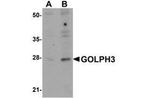 Western blot analysis of GOLPH3 in rat lung tissue lysate with AP30372PU-N GOLPH3 antibody at (A) 0.
