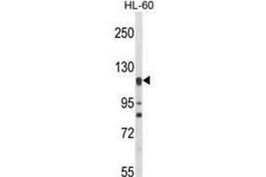 Western blot analysis of NOS3 Antibody (N-term) in HL-60 cell line lysates (35ug/lane). (ENOS Antikörper  (N-Term))