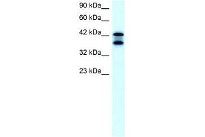 ACAT2 antibody used at 2 ug/ml to detect target protein. (ACAT2 Antikörper)