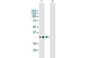 Western Blot analysis of ADAMTS4 expression in transfected 293T cell line by ADAMTS4 MaxPab polyclonal antibody. (ADAMTS4 Antikörper  (AA 1-339))