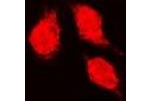 Immunofluorescent analysis of Glutathione Synthetase staining in K562 cells. (Glutathione Synthetase Antikörper)
