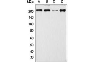 Western blot analysis of CD205 expression in MCF7 (A), SP2/0 (B), H9C2 (C), mouse lymph node (D) whole cell lysates. (LY75/DEC-205 Antikörper  (Center))