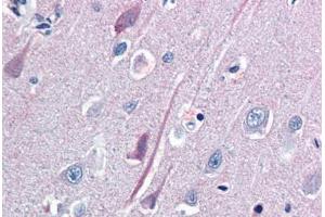 Human Brain, Cortex (formalin-fixed, paraffin-embedded) stained with TrkB antibody ABIN337266 at 10 ug/ml followed by biotinylated goat anti-rabbit IgG secondary antibody ABIN481713, alkaline phosphatase-streptavidin and chromogen. (TRKB Antikörper  (AA 1-429))