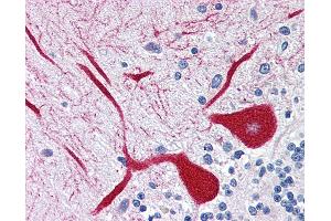 Immunohistochemistry (IHC) image for anti-Inositol 1,4,5-Trisphosphate Receptor, Type 1 (ITPR1) (AA 1892-1911) antibody (ABIN337359)