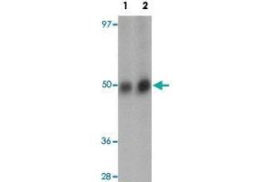 Western blot analysis of RNF8 in human lung tissue lysate with RNF8 polyclonal antibody  at (1) and (2) 2 ug/mL. (RNF8 Antikörper  (C-Term))