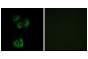 Immunofluorescence analysis of A549 cells, using CELSR3 antibody. (CELSR3 Antikörper  (C-Term))
