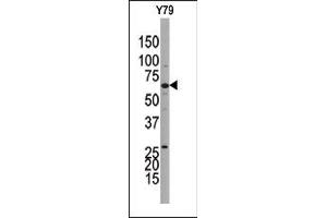 Image no. 1 for anti-Guanylate Cyclase 1, Soluble, beta 3 (GUCY1B3) (C-Term) antibody (ABIN360701) (GUCY1B3 Antikörper  (C-Term))