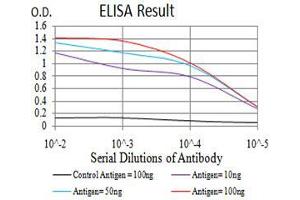 Black line: Control Antigen (100 ng), Purple line: Antigen(10 ng), Blue line: Antigen (50 ng), Red line: Antigen (100 ng),