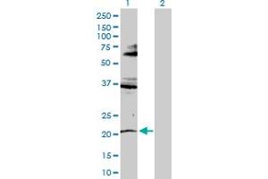 RNF135 Antikörper  (AA 1-210)