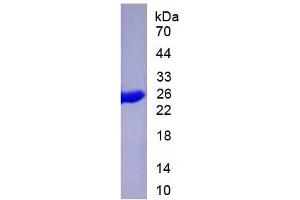 SDS-PAGE (SDS) image for Keratin 19 (KRT19) ELISA Kit (ABIN6574265)