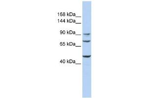 GALNT5 antibody used at 1 ug/ml to detect target protein. (GALNT5 Antikörper)