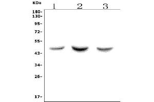 Western blot analysis of ASAH1 using anti-ASAH1 antibody (ABIN7602206).