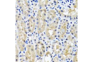 Immunohistochemistry of paraffin-embedded mouse kidney using SNAP29 antibody at dilution of 1:100 (x40 lens). (SNAP29 Antikörper)