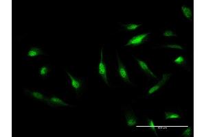 Immunofluorescence of monoclonal antibody to CAND1 on HeLa cell. (CAND1 Antikörper  (AA 1-100))