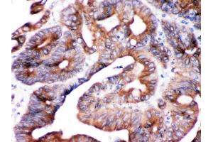 IHC analysis of SPTLC1 using anti-SPTLC1 antibody (ABIN3044549).