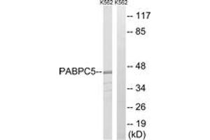 Western blot analysis of extracts from K562 cells, using PABPC5 Antibody. (PABPC5 Antikörper  (AA 184-233))