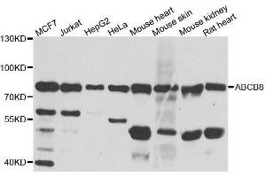 Western blot analysis of extracts of various cell lines, using ABCB8 antibody. (ABCB8 Antikörper  (AA 469-718))