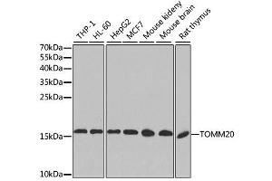 Western blot analysis of extracts of various cell lines, using TOMM20 antibody. (TOMM20 Antikörper  (AA 20-145))