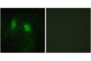 Immunofluorescence analysis of HeLa cells, using IKK-gamma (Ab-85) Antibody. (IKBKG Antikörper  (AA 51-100))