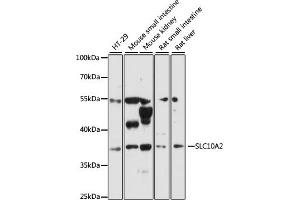 Western blot analysis of extracts of various cell lines, using SLC10 antibody (ABIN6130693, ABIN6147837, ABIN6147838 and ABIN6216622) at 1:3000 dilution.