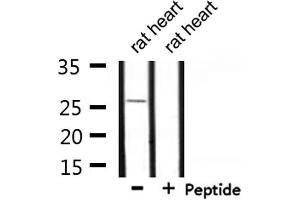 Western blot analysis of extracts from rat heart, using UBTD2 Antibody.