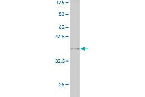 Western Blot detection against Immunogen (36. (MLLT10 Antikörper  (AA 695-793))