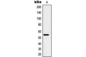 Western blot analysis of Peripherin expression in HeLa (A) whole cell lysates.