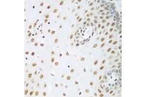 Immunohistochemistry of paraffin-embedded human esophagus using HDAC1 antibody. (HDAC1 Antikörper  (AA 393-482))