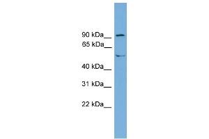 WB Suggested Anti-TEC Antibody Titration:  0.