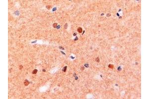ABIN190775 (2µg/ml) staining of paraffin embedded Human Brain. (CD11b Antikörper  (Internal Region))