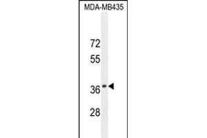 CADM1 Antibody (N-term) (ABIN654660 and ABIN2844356) western blot analysis in MDA-M cell line lysates (35 μg/lane). (CADM1 Antikörper  (N-Term))