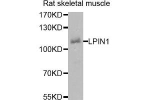 Western blot analysis of extracts of rat skeletal muscle cells, using LPIN1 antibody.