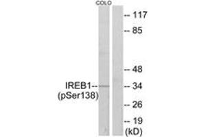 Western Blotting (WB) image for anti-Aconitase 1 (ACO1) (AA 106-155), (pSer138) antibody (ABIN1531675) (Aconitase 1 Antikörper  (pSer138))