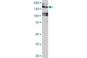 EIF4G3 monoclonal antibody (M02), clone 1D7 Western Blot analysis of EIF4G3 expression in Jurkat . (EIF4G3 Antikörper  (AA 1-515))